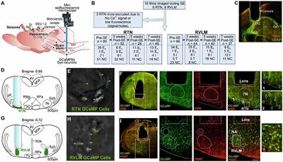 Neural correlate of reduced respiratory chemosensitivity during chronic epilepsy